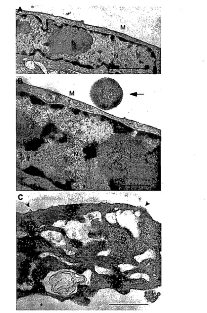 Figure  2.  TEM  micro~raphs  showing  the  PBMEC  in jury caused  by  S.  suis  at  a concentration  of  10  CFU/ml