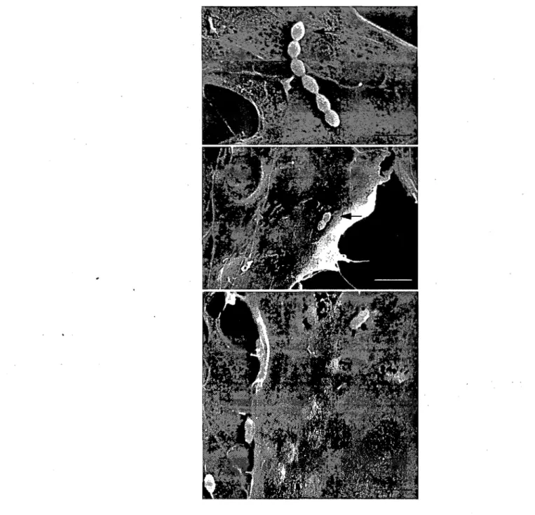 Figure  4.  SEM  micrographs  showing  S.  suis  (10 6  CFU/ml)  interactions  with  PBMEC  after  5  min  (A)  and  2  h  (B  and  C)  of  incubation