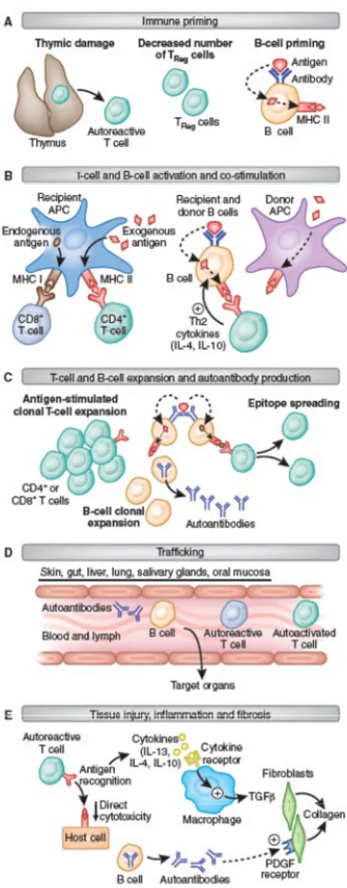 Figure 6 : Étapes de la GVHD chronique chez la souris. La progression de la GVHD chronique peut-être 