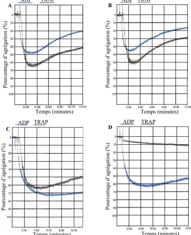 Figure 1 : Exemple de courbes dagrégation avant et 30 jours après le début du  traitement au placebo ou au SCH 530348
