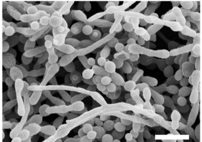 Figure 1. 4 Candida albicans biofilms. 