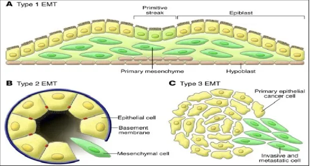 Figure 6: Different types of Epithelial-Mesenchymal-Transition: 