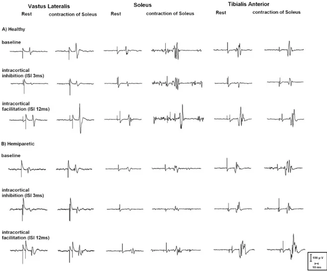 Figure 1. MEP raw data 