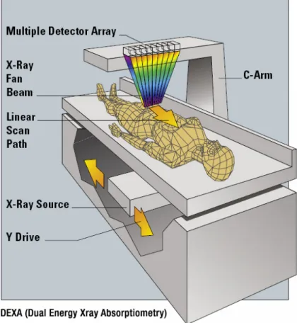 Figure 3 : Appareil de mesure DEXA. 