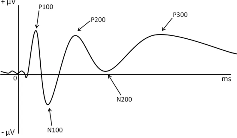 Figure 1 – courbe de potentiels évoqués idéale 