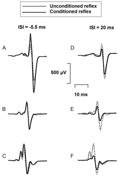 Figure 2. Effects of femoral nerve stimulation on soleus H reflex. 