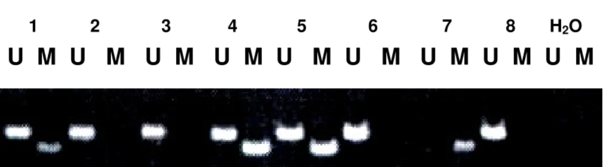 Figure 3 – Gel electrophoresis 