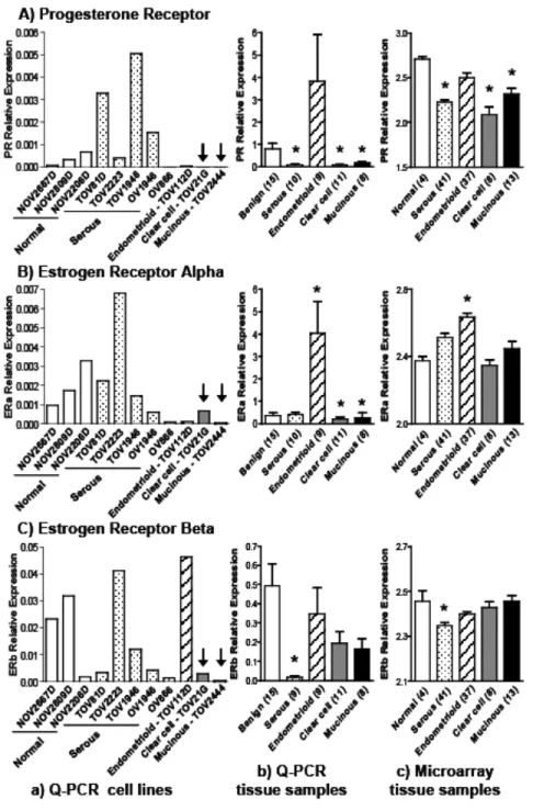 Figure 2. Expression of progesterone  receptor (A), and estrogen receptors alpha  (B)  and beta (C) in ovarian cancer cell lines and tissue samples