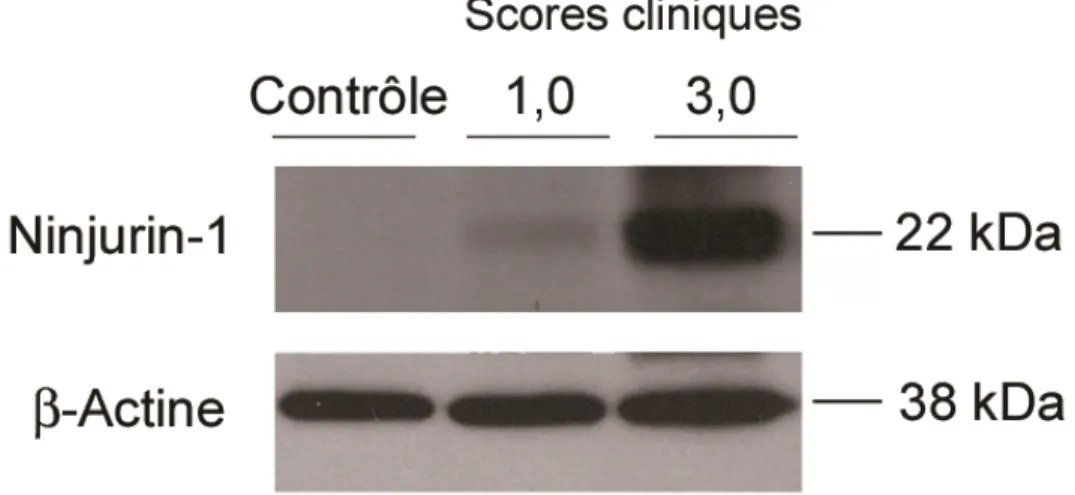 Figure 8 : L’expression de Ninjurin-1 augmente dans le SNC des souris atteintes  d’EAE au pic de la maladie par immunobuvardage 