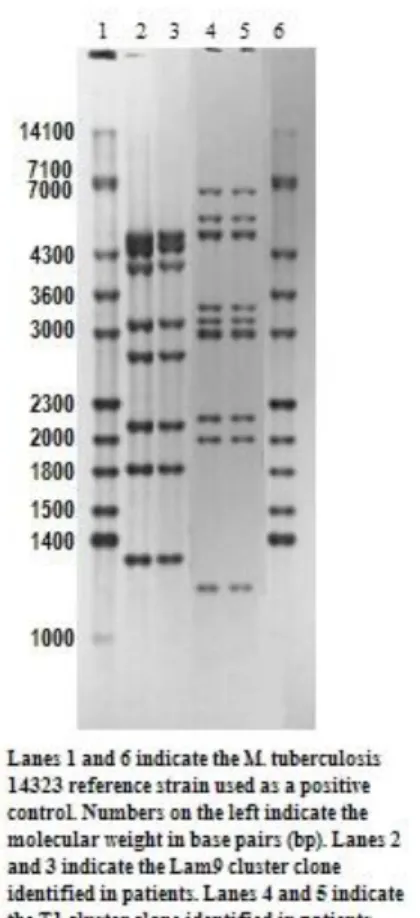 FIGURE 4.5.  IS6110 RFLP hybridization pattern for Lam 9 and T1 cluster clones of  multi-drug resistant Mycobacterium tuberculosis identified in Lima, Peru between 1999  and 2005