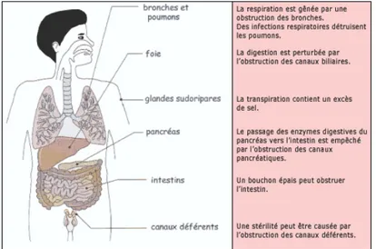 Figure 2 Les différents organes touchés par la fibrose kystique.
