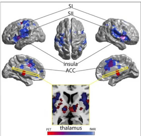 Figure 2. Comparison of the sensitivity and resolution of fMRI and PET 