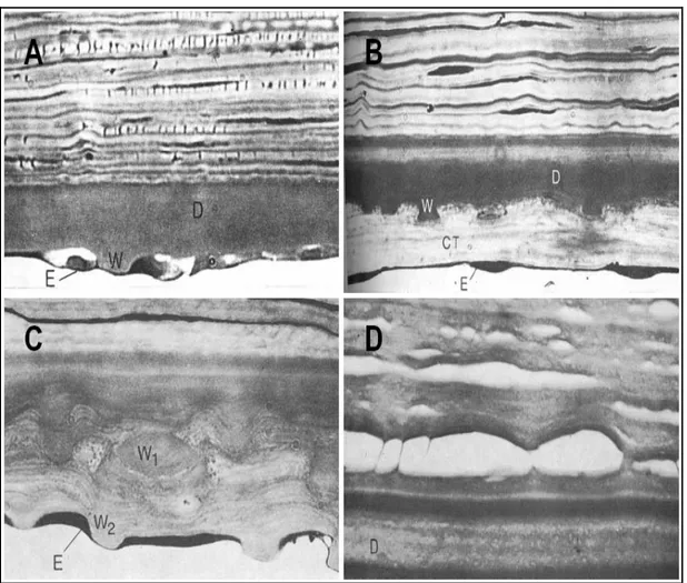 Figure 2.11:  Classification histologique de Hogan: formes morphologiques de la membrane de 