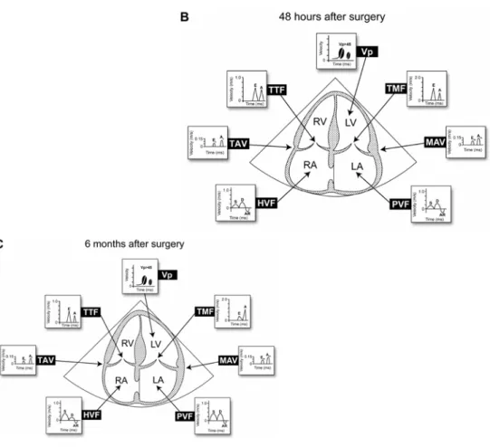 Figure 10 Biventricular cardiac dimensions and Doppler during CABG 