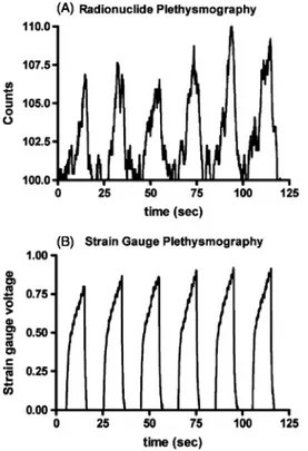 Figure  1.  Baseline  measurements  from  (A)  radionuclide  plethysmography  and  (B)  strain  gauge plethysmography