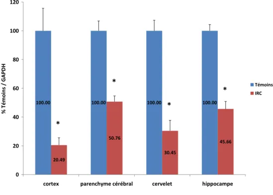Figure 3 : Effet de l’insuffisance rénale chronique (IRC) sur l’expression  protéique de l’isoforme 2C11 dans les microsomes de cerveau de rat