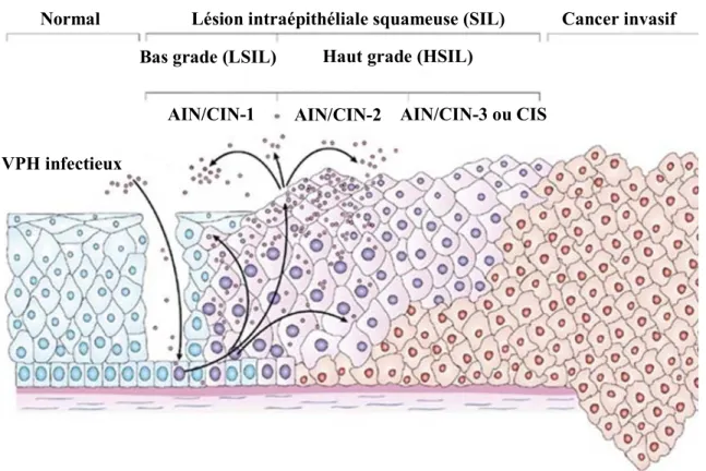 Figure 9. Progression de l’infection au virus du papillome humain.  L’infection au VPH peut être décrite comme un processus en continuum