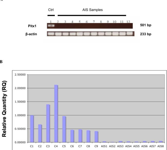 Figure 3.1: Comparison of Pitx1 expression in AIS and normal osteoblasts.  A. A 