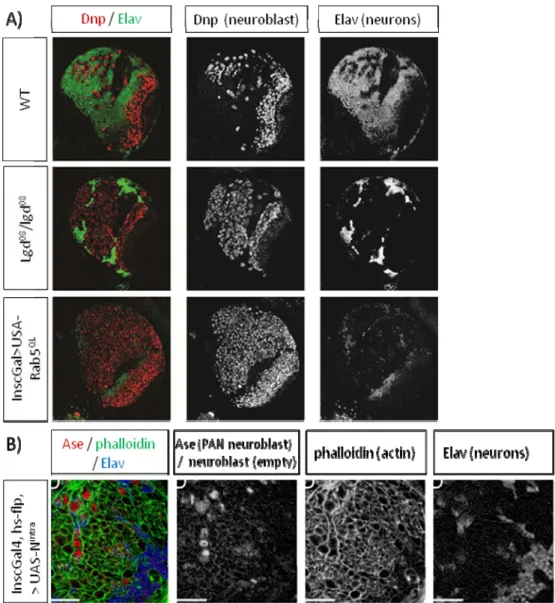 Figure 7: Perturbations of the endocytic pathway induce stem-cell tumors in the  larval brain which resembles Notch over expression phenotype