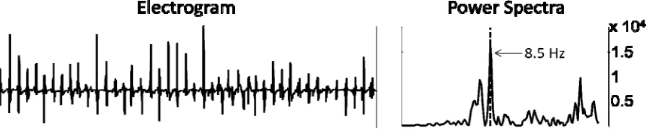 Fig. 2  Example of atrial electrogram recording and its corresponding power spectra. The  dominant frequency of 8.5 Hz corresponds to the frequency with the highest power