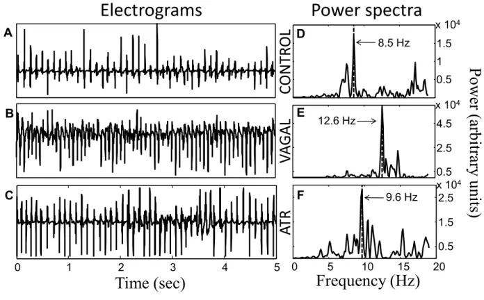 Figure 10 CONTROLATRVAGALTime (sec)Electrograms Frequency (Hz) Power spectra Power (arbitrary units)012345 051015200.51.52.5x 1040.52.54.5x 1040.511.5x 1048.5 Hz12.6 Hz9.6 HzABCDEF