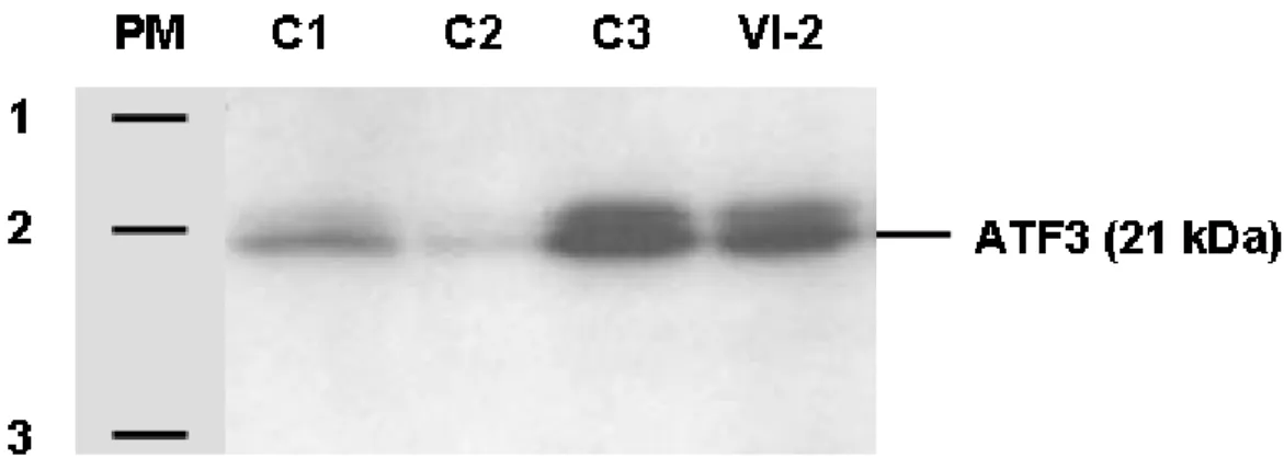 Figure 10. Immunobuvardage de type Western contre ATF3. Les numéros 1, 2 et 3  représentent les bandes indiquant les poids moléculaires 37,1 kDa, 25,9 kDa et 19,4 kDa,  respectivement