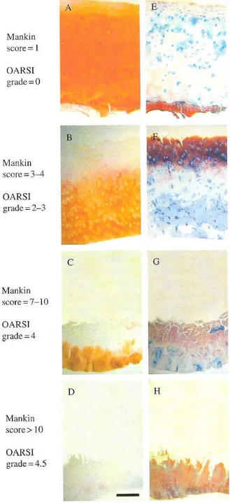 Figure 6 : Changements histologiques du cartilage (adapté de Roach HI et al., Bone and  Osteoarthritis, Volume 4, Bronner/Farach-Carson Eds, 2007) 