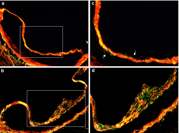 Figure 8. Aortic valve leaflet cross sections for Sirius red staining (20x  magnification) of a) WT and b) WrnΔhel mouse