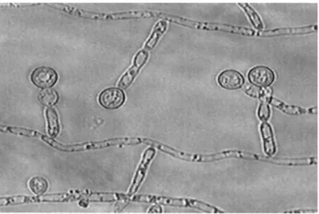 Figure 5. Photo représentant des chlamydospores (139)