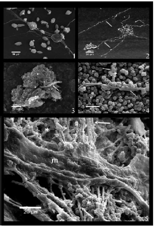 Figure 11. Photo prise par microscopie électronique des étapes de formation  du biofilm chez C