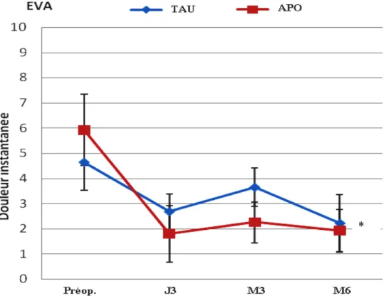 Figure 2 : Profil de l'intensité de la douleur instantanée 