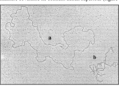 Figure 3 : Photographie prise au  microscope électronique d’un  plasmide de 9 Kb sous forme  relaxé (a) et surenroulé (b)