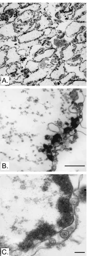 FIG. 1. Purity and integrity of isolated  nuclei. Nuclei isolated from HSV-1  17+-infected HeLa cells were mounted  in Epon and analyzed by electron  microscopy