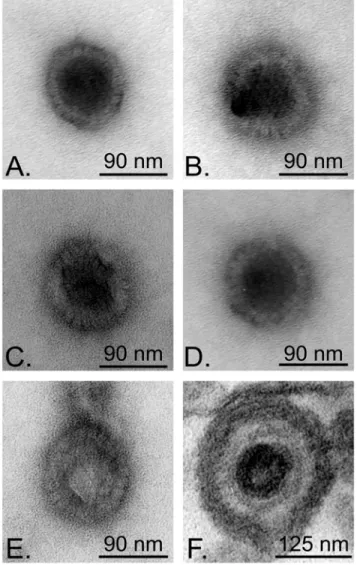 FIG. 7. Negative staining of capsids liberated during the in vitro assay. HSV-1 17+- 17+-infected nuclei were incubated for 6 h at 37°C with energy and (A) mock-treated or (B to  E) infected cytosol