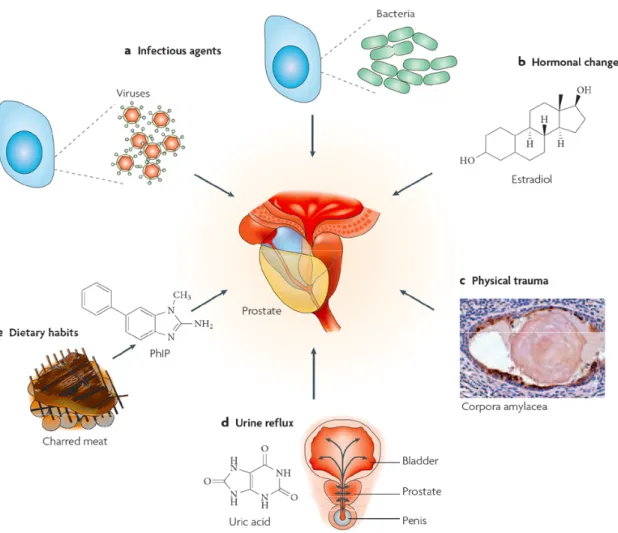 Figure 2. Causes of prostatic inflammation.  