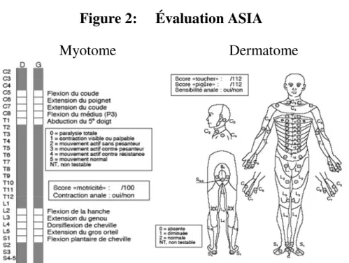 Figure 2:     Évaluation ASIA 
