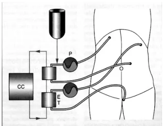 Figure 1 : Schéma du montage de CHIP  