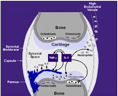 Figure 9: Inflammation, détérioration de l’os  et du cartilage dans le cas RA causées par les   médiateurs pro inflammatoires dont les plus connus l’IL-1 et la TNF-α illustrées ci-dessus)