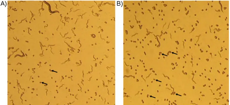 Figure 11. The knockdown of the apn-1 gene causes the accumulation of unhatched  eggs