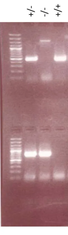 Figure 8.  Gel de génotypage.  Représentation des produits PCR et leur  migration sur gel d’agarose