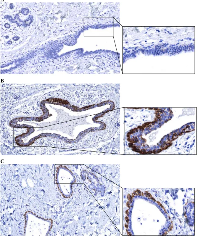 Figure 9. Expression  des  marqueurs  du  cancer  du  sein  dans  le  sein  normal :                    (A) absence de la protéine HER-2; (B) cytokératines 5 et 6 (CK5/6); (C) cytokératine 14 