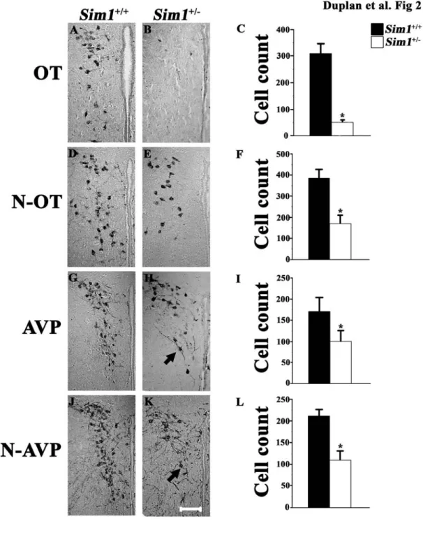 Figure 2. Decrease of OT and AVP production of in the PVN of Sim1 +/-  mice.