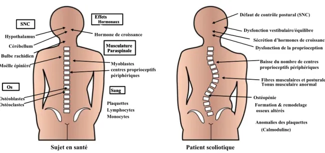 Figure 2. Systèmes ciblés par l’action de la mélatonine et symptômes observés  chez les patients scoliotiques
