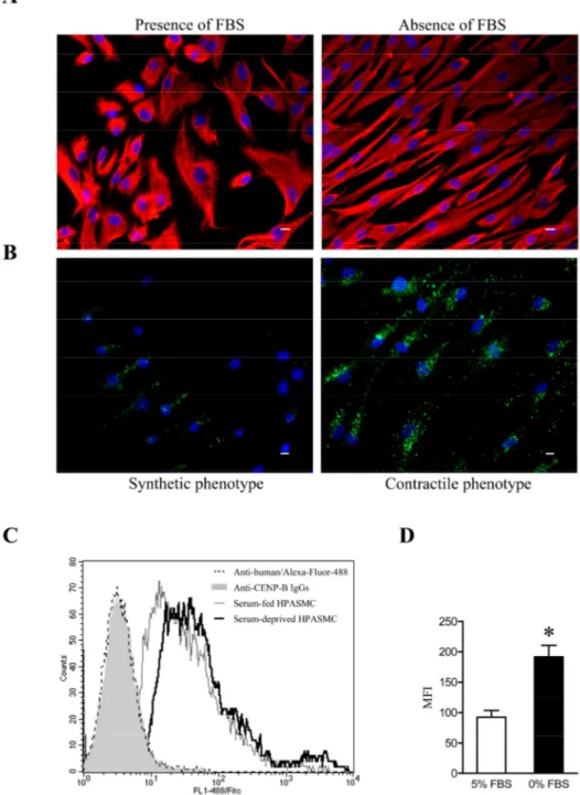 Figure 2. Phenotypic modulation of human pulmonary artery SMCs affects CENP-B  binding