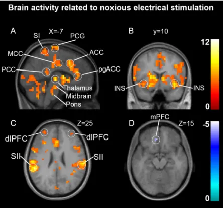 Figure 4: Brain activity associated with trial-to-trial fluctuations in the RIII reflex 