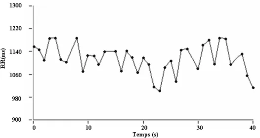 Figure 1.3 Représentation d’un tachogramme.  Les intervalles RR (temps écoulé entre deux  battements cardiaques) sont calculés à partir de l’ECG et représentés dans ce graphique par  un point
