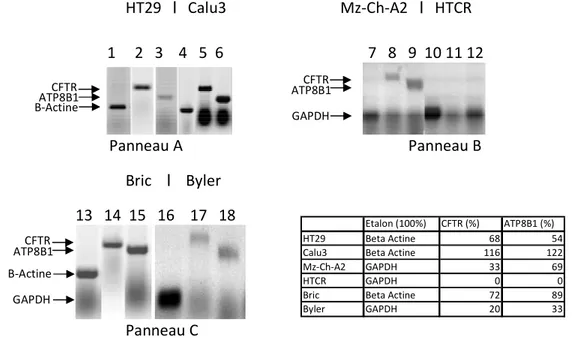 Figure 7 : Résultats de RT-PCR pour les lignées HT29, Calu-3 (Panel A); Mz-ChA-2, HTCR  (Panel B) et Bric, Byler (Panel C)