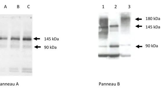 Figure 9a: Immunodétection d'ATP8B1 pour des quantités croissantes (20, 40, 60μg) de  protéines totales de la lignée Calu-3 (Panneau A) et pour 80 μg de protéines totales des  lignées HT-29(1), Bric (2) et Byler (3) (Panneau B)