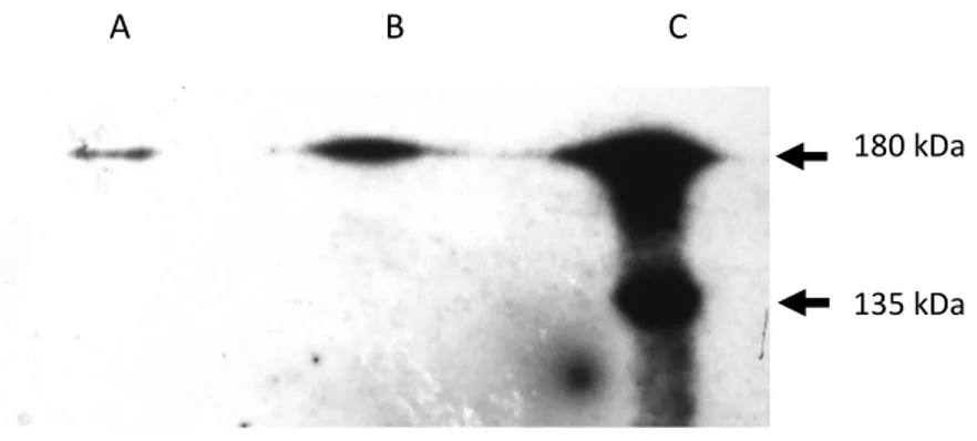 Figure 10: Immunodétection de la protéine CFTR pour 100μg de protéines totales extraites  des lignées Byler (A), Bric (B) et Calu-3(C)