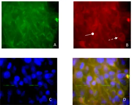 Figure 13 : Détection par immunofluorescence d'ATP8B1 et de CFTR pour la lignée Byler 